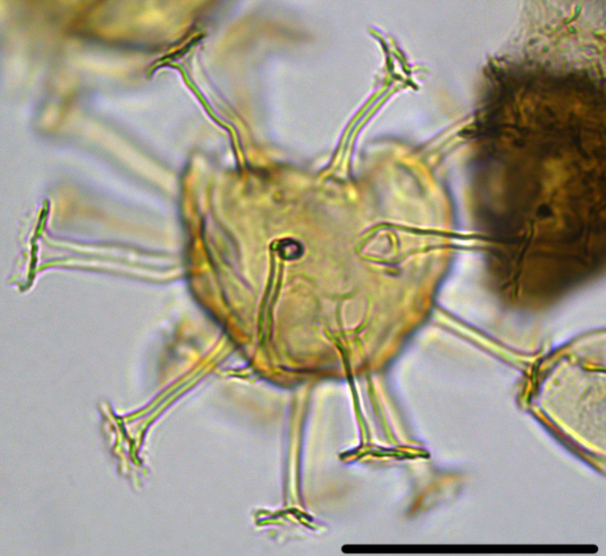 Hystrichosphaeridium tubiferum Htub27X23334385965a.jpg